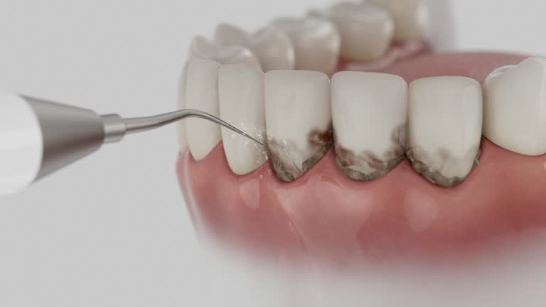 Reliable Dental Implants contractor in Tyhee, ID by Smile Center Dentistry